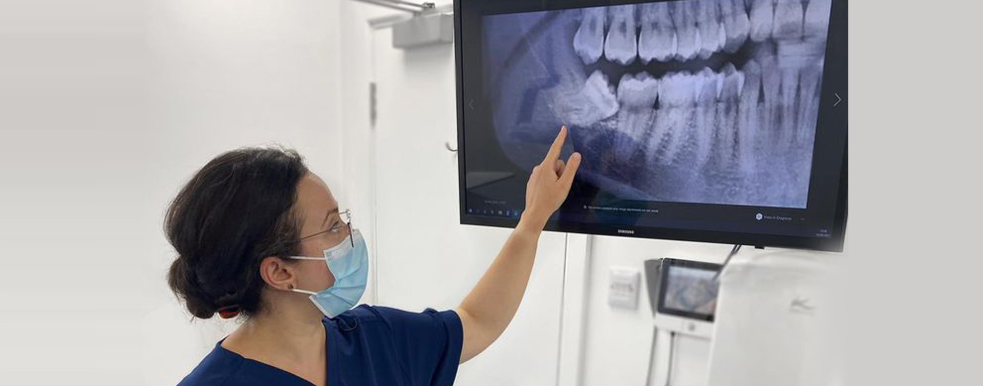 Tooth extractions