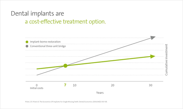 implant-faq-treatment_costs
