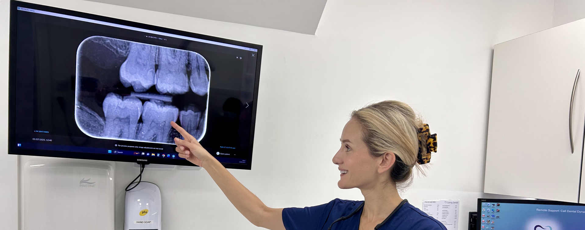 X-rays & digital imaging